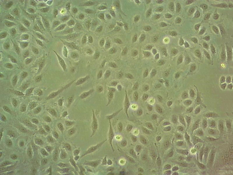 NCI-H1792 Epithelial Cell|人肺癌腺癌传代细胞(有STR鉴定),NCI-H1792 Epithelial Cell