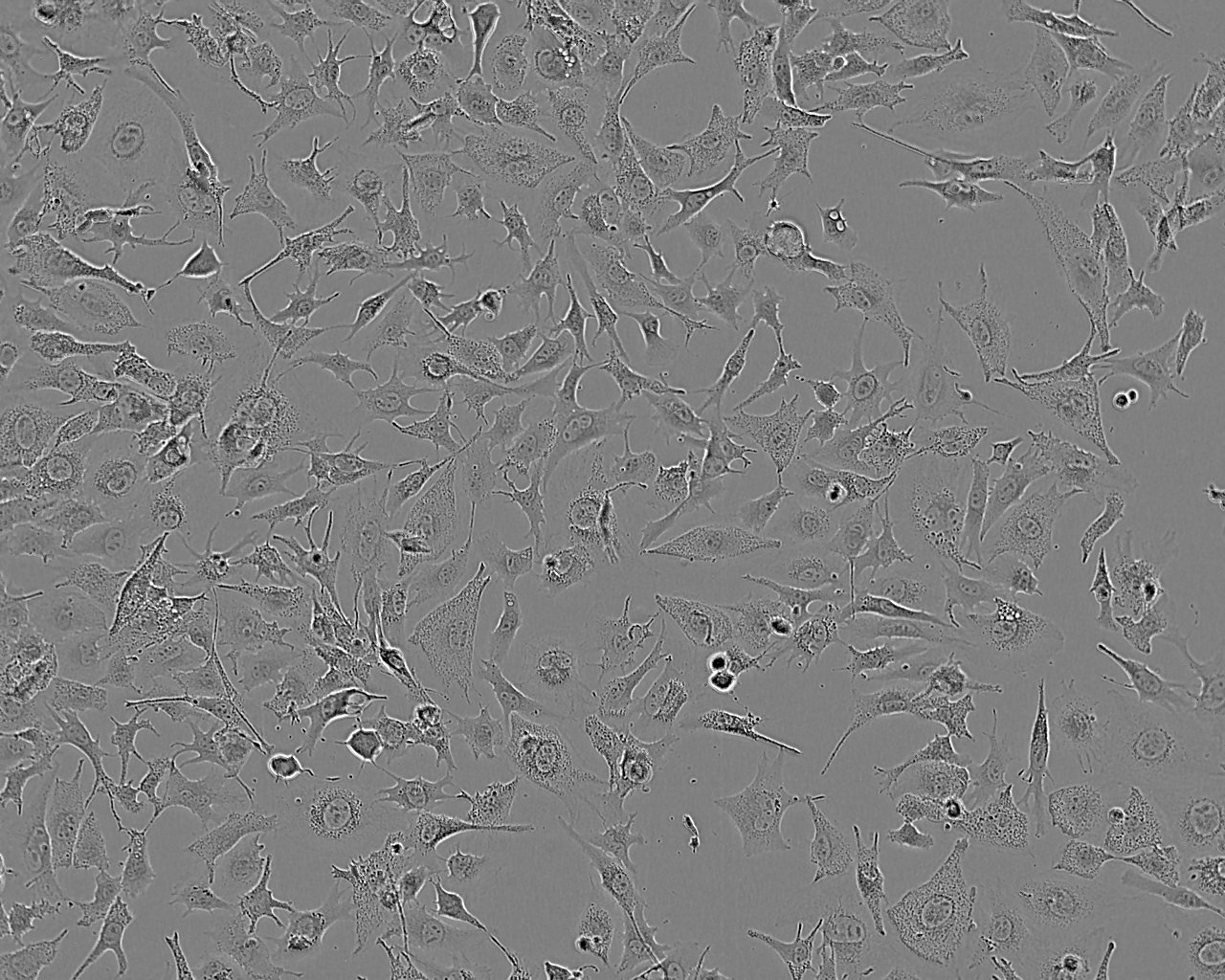 NCI-H2228 Epithelial Cell|人非小細胞肺癌傳代細胞(有STR鑒定),NCI-H2228 Epithelial Cell