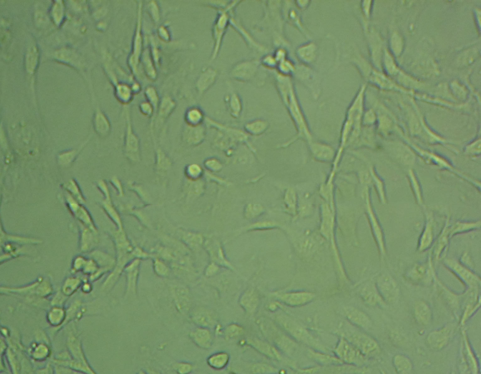 NCI-H1581 Epithelial Cell|人非小细胞肺癌传代细胞(有STR鉴定),NCI-H1581 Epithelial Cell