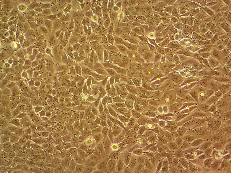 NCI-H2172 Epithelial Cell|人非小细胞肺癌传代细胞(有STR鉴定),NCI-H2172 Epithelial Cell