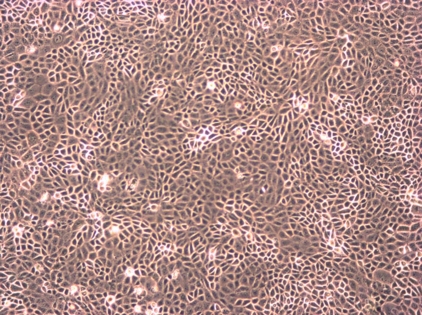 DMS 79 Epithelial Cell|人小细胞肺癌传代细胞(有STR鉴定),DMS 79 Epithelial Cell