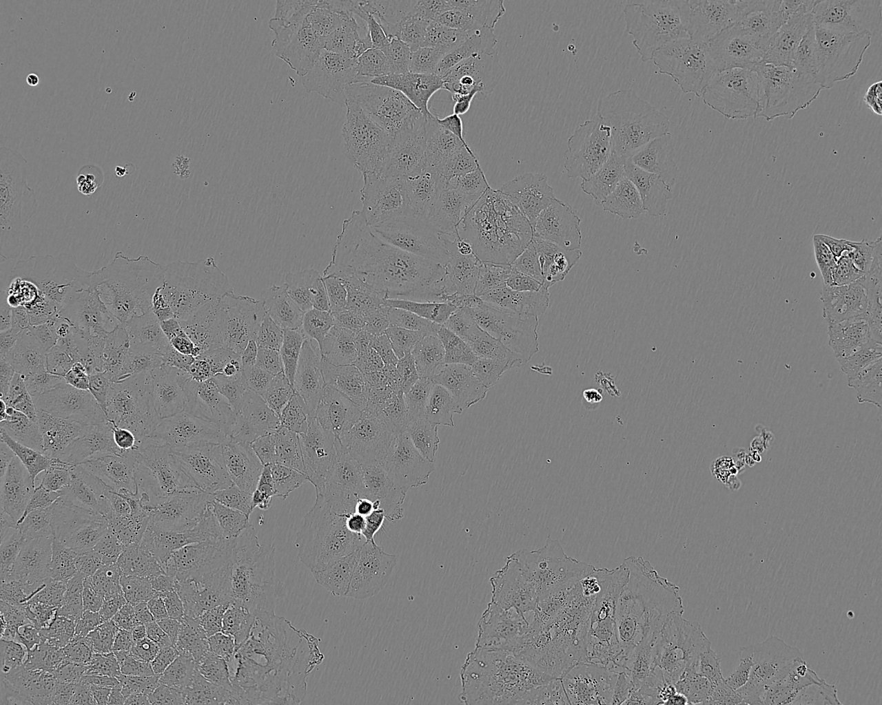NCI-H2141 Epithelial Cell|人小细胞肺癌传代细胞(有STR鉴定),NCI-H2141 Epithelial Cell