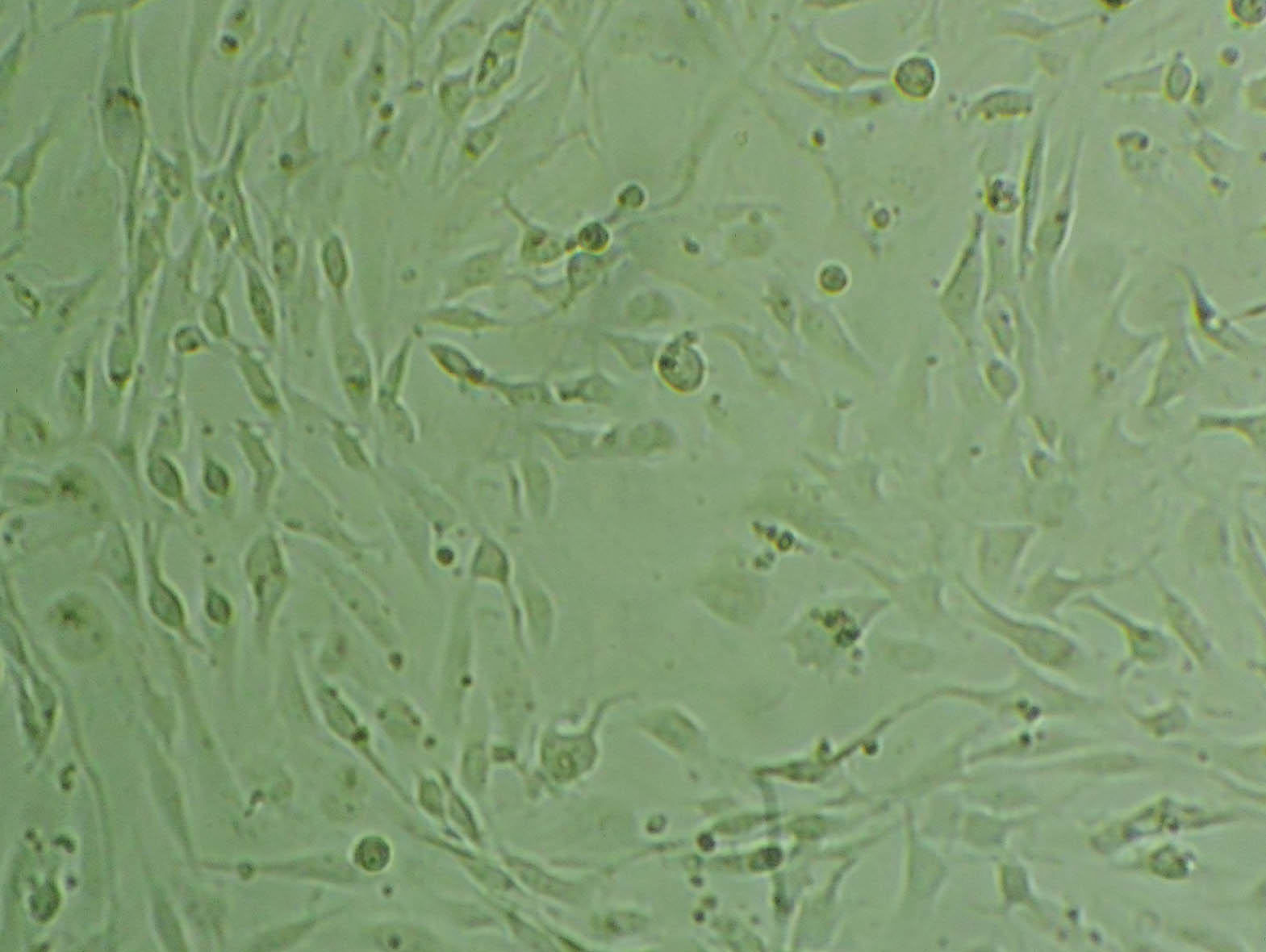 SHP-77 Epithelial Cell|人肺癌传代细胞(有STR鉴定),SHP-77 Epithelial Cell