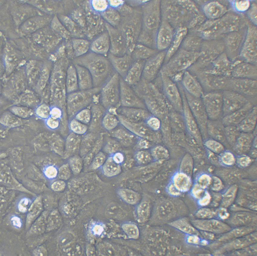 NCI-H1618 Epithelial Cell|人小细胞肺癌传代细胞(有STR鉴定),NCI-H1618 Epithelial Cell