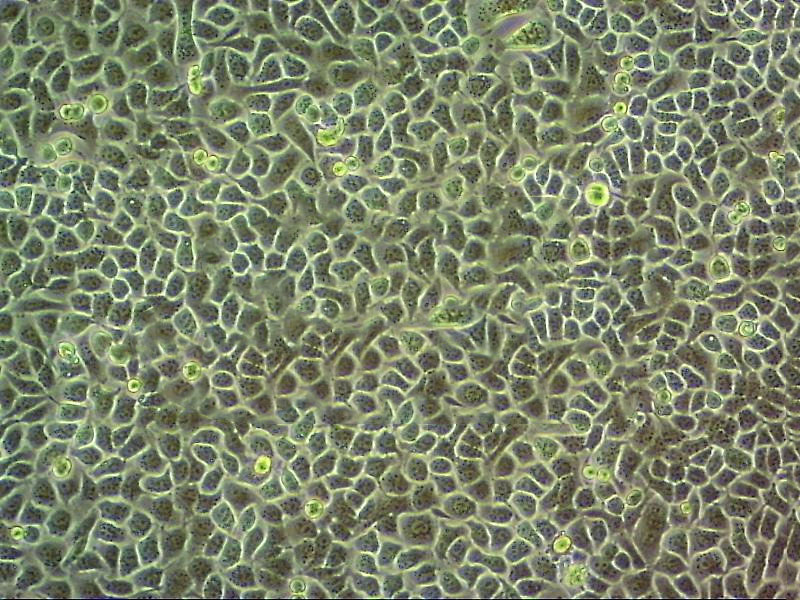 NCI-H1694 Epithelial Cell|人小细胞肺癌传代细胞(有STR鉴定),NCI-H1694 Epithelial Cell