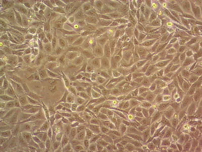 RD Epithelial Cell|人恶性胚胎横纹肌瘤传代细胞(有STR鉴定),RD Epithelial Cell