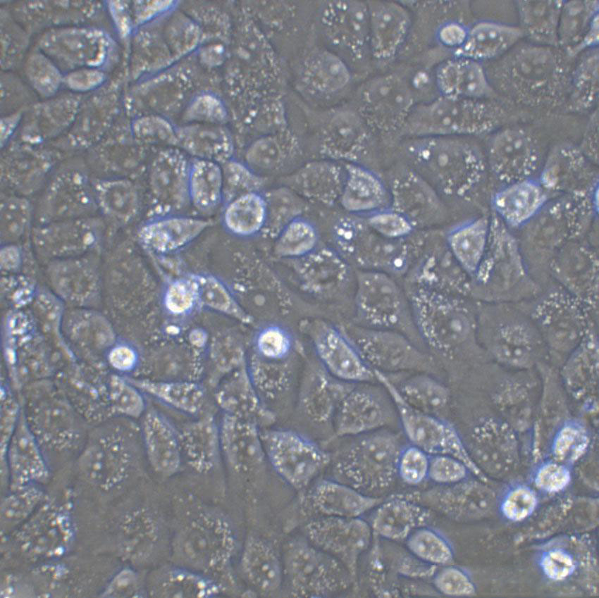 TOV-21G Epithelial Cell|人上皮性卵巢癌传代细胞(有STR鉴定),TOV-21G Epithelial Cell