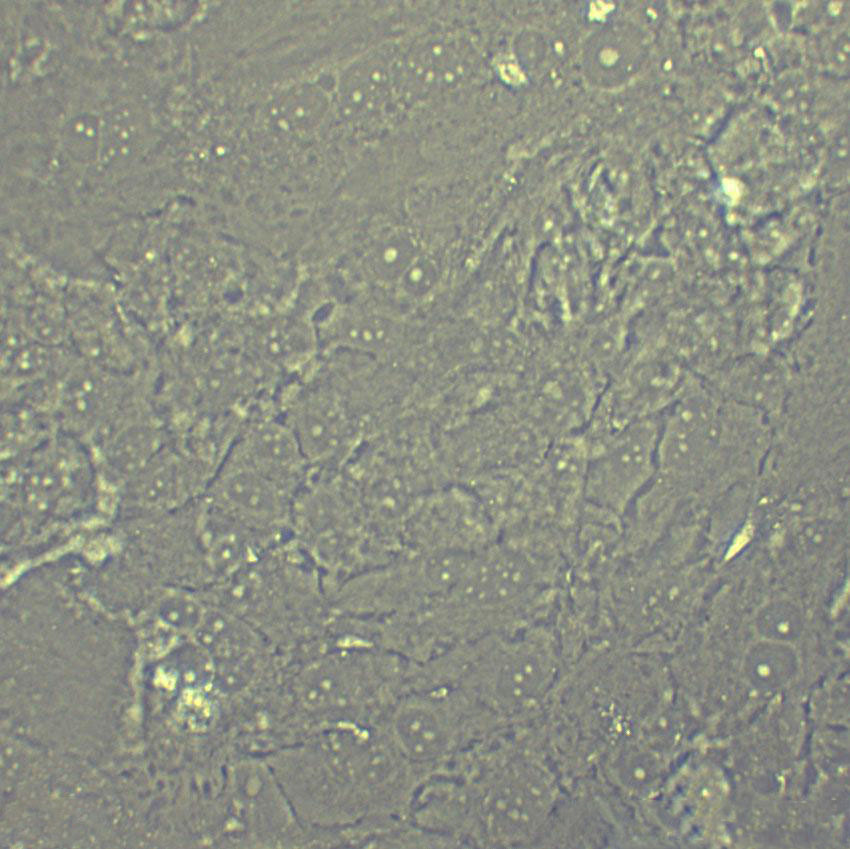 MeWo Epithelial Cell|人恶性黑色素瘤传代细胞(有STR鉴定),MeWo Epithelial Cell