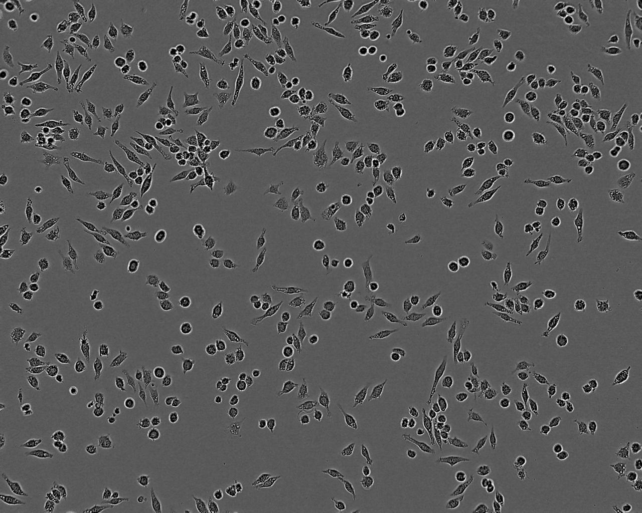 SNU-1 Epithelial Cell|人胃癌传代细胞(有STR鉴定),SNU-1 Epithelial Cell