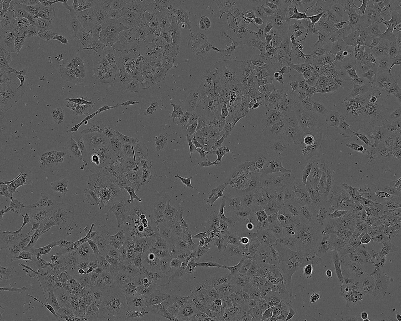 MKN1 Epithelial Cell|人胃癌傳代細(xì)胞(有STR鑒定),MKN1 Epithelial Cell