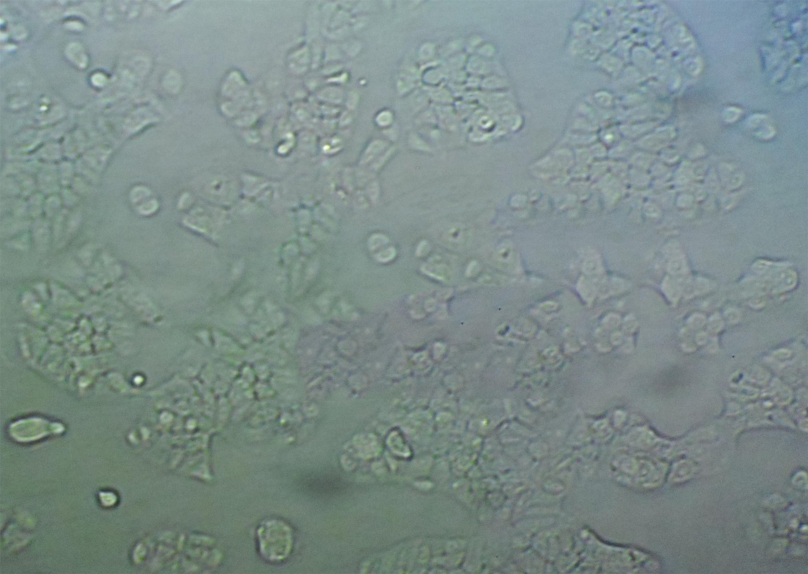 ARIP Epithelial Cell|人胰腺肿瘤传代细胞(有STR鉴定),ARIP Epithelial Cell