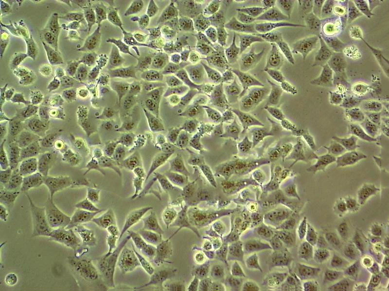 AZ-521 Epithelial Cell|人胃癌传代细胞(有STR鉴定),AZ-521 Epithelial Cell