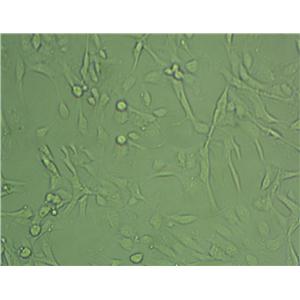 NCI-H1581 Epithelial Cell|人非小细胞肺癌传代细胞(有STR鉴定)