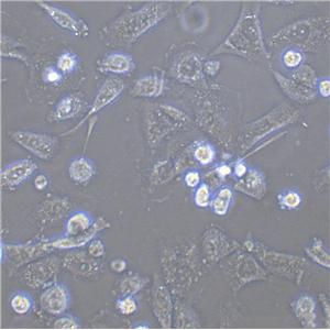 NCI-H2029 Epithelial Cell|人小细胞肺癌传代细胞(有STR鉴定)
