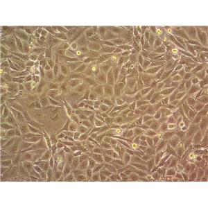 RD Epithelial Cell|人恶性胚胎横纹肌瘤传代细胞(有STR鉴定)