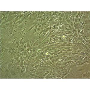 COV434 Epithelial Cell|人卵巢颗粒肿瘤传代细胞(有STR鉴定)