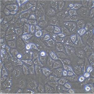 TOV-21G Epithelial Cell|人上皮性卵巢癌传代细胞(有STR鉴定)