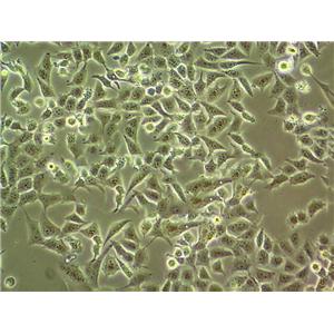 HuP-T4 Epithelial Cell|人胰腺癌传代细胞(有STR鉴定)