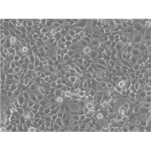 KATO III Epithelial Cell|人胃癌传代细胞(有STR鉴定),KATO III Epithelial Cell