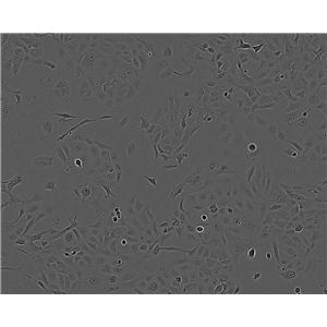 MKN1 Epithelial Cell|人胃癌傳代細(xì)胞(有STR鑒定)