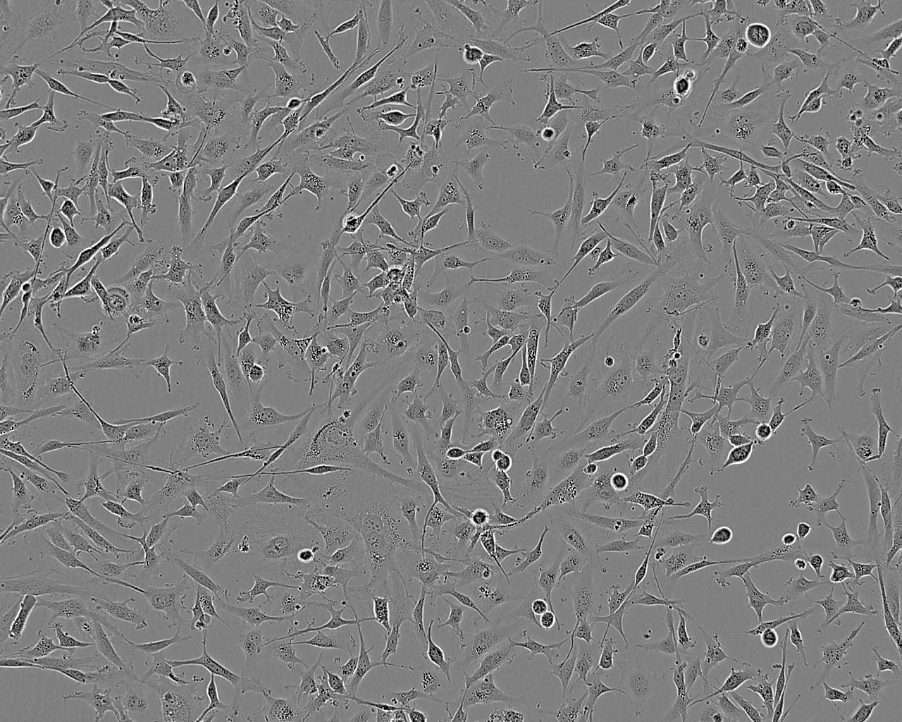 SPC-A1 Epithelial Cell|人肺腺癌传代细胞(有STR鉴定),SPC-A1 Epithelial Cell