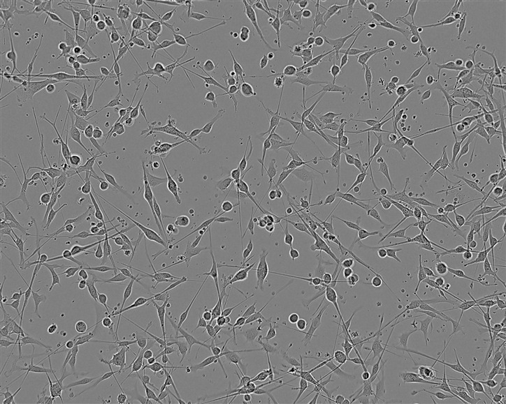 FOX-NY Epithelial Cell|小鼠骨髓瘤传代细胞(有STR鉴定),FOX-NY Epithelial Cell