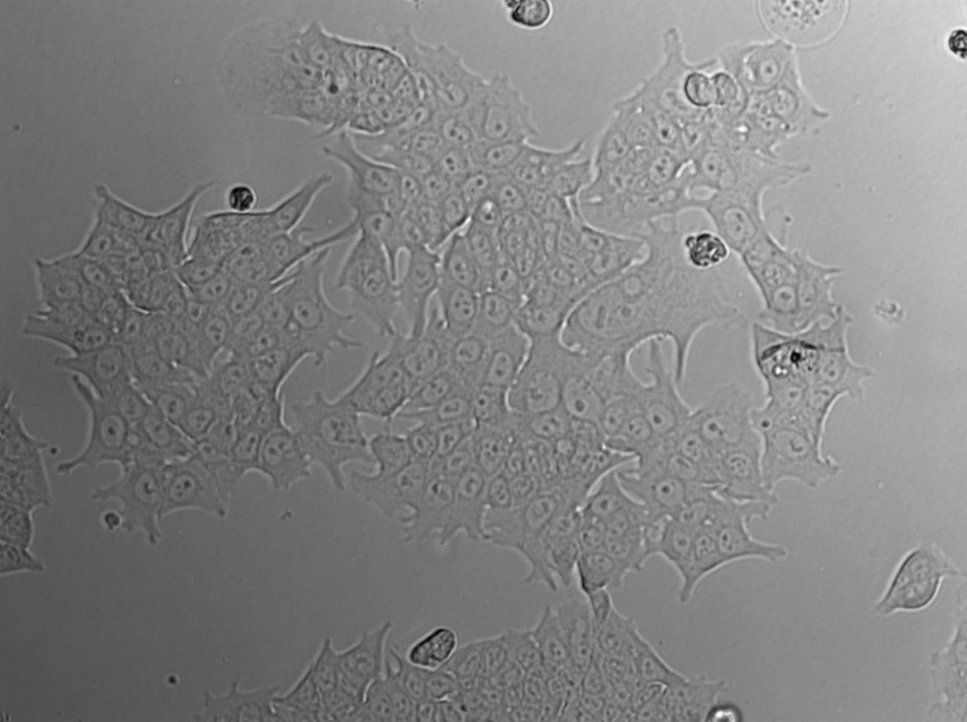 CAL-62 Epithelial Cell|人甲状腺癌传代细胞(有STR鉴定),CAL-62 Epithelial Cell