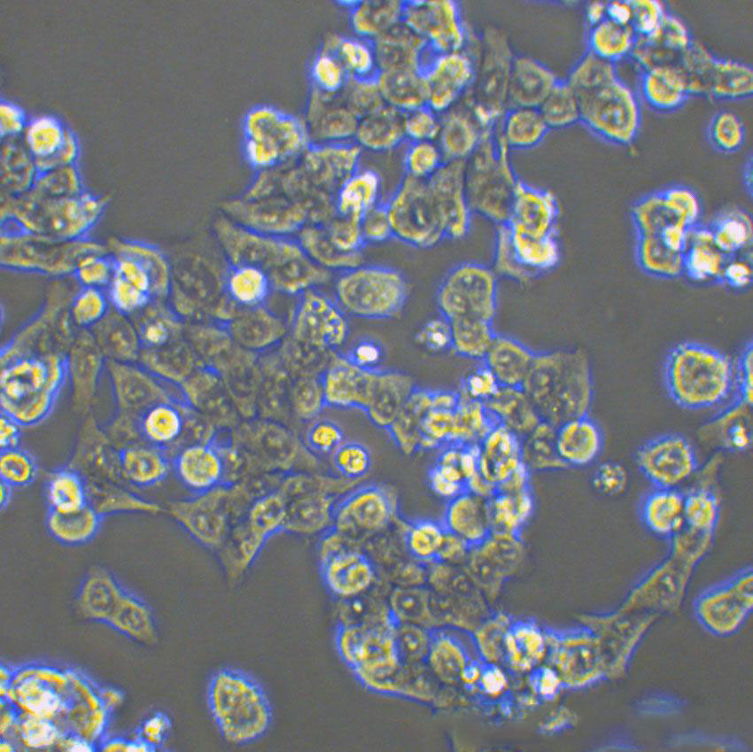 CAL-120 Epithelial Cell|人乳腺癌传代细胞(有STR鉴定),CAL-120 Epithelial Cell