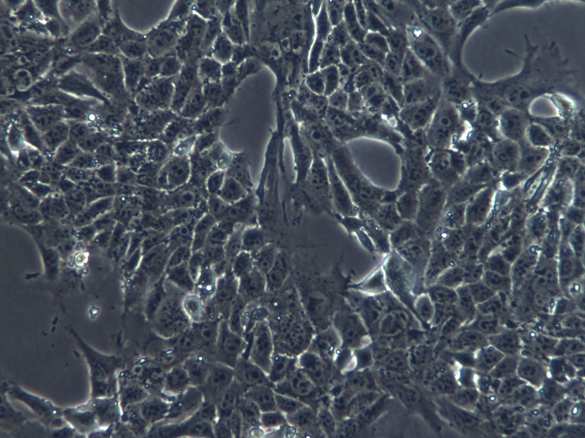 SNU-869 Epithelial Cell|人胆管癌传代细胞(有STR鉴定),SNU-869 Epithelial Cell