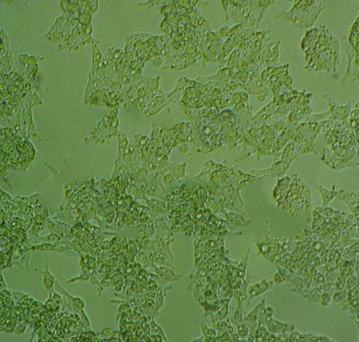 SW780 Epithelial Cell|人膀胱移行癌傳代細(xì)胞(有STR鑒定),SW780 Epithelial Cell