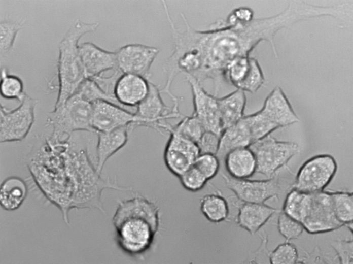 CC-LP-1 Epithelial Cell|人胆管癌传代细胞(有STR鉴定),CC-LP-1 Epithelial Cell
