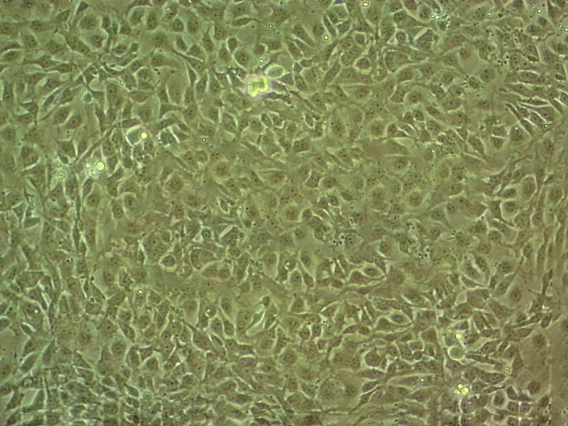COLO 206F Epithelial Cell|人结肠癌传代细胞(有STR鉴定),COLO 206F Epithelial Cell