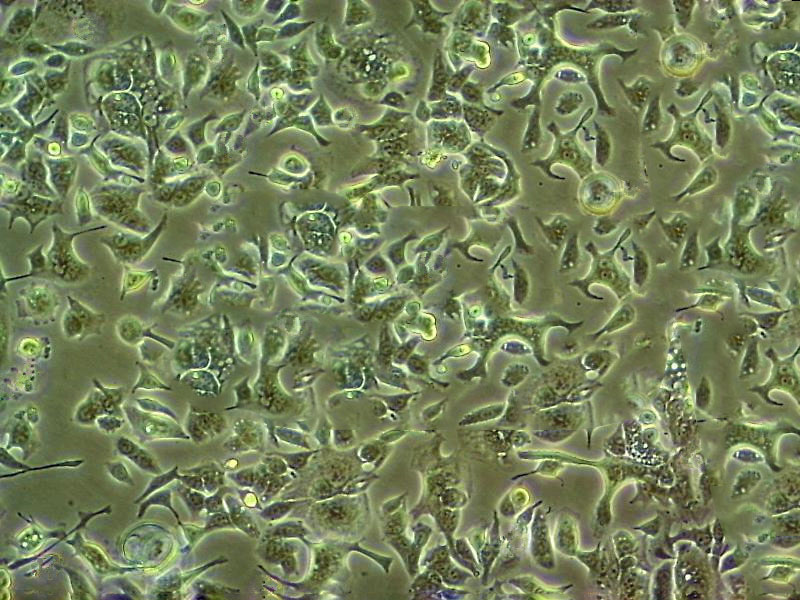 COLO 824 Epithelial Cell|人乳腺癌传代细胞(有STR鉴定),COLO 824 Epithelial Cell