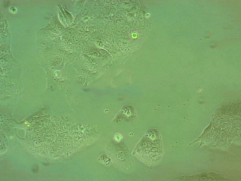 SNU-601 Epithelial Cell|人胃癌传代细胞(有STR鉴定),SNU-601 Epithelial Cell