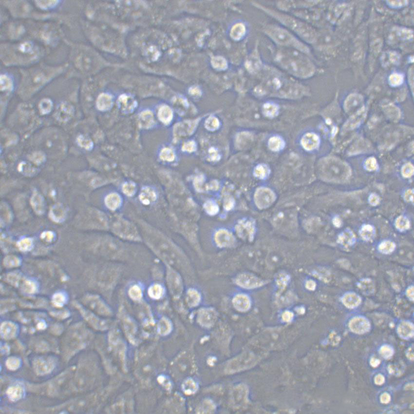 SW756 Epithelial Cell|人子宫鳞状癌传代细胞(有STR鉴定),SW756 Epithelial Cell