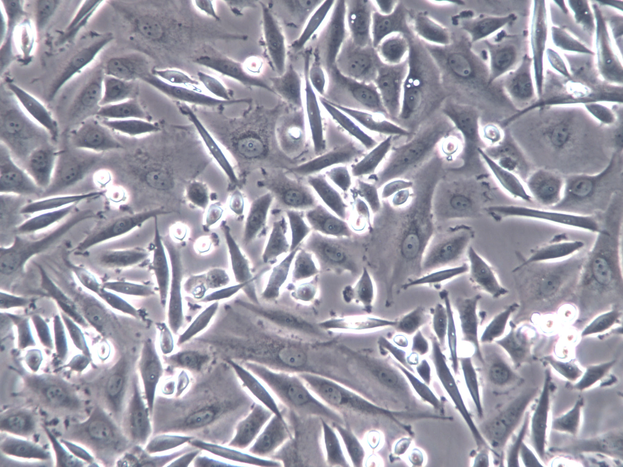 NUGC-2 Epithelial Cell|人低分化胃癌腺癌传代细胞(有STR鉴定),NUGC-2 Epithelial Cell