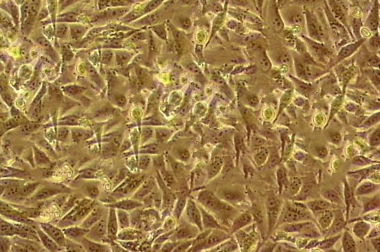 HCC95 Epithelial Cell|人肺鳞状细胞癌传代细胞(有STR鉴定),HCC95 Epithelial Cell