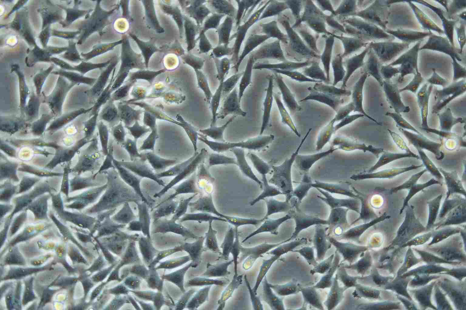 SNU-484 Epithelial Cell|人胃癌傳代細(xì)胞(有STR鑒定),SNU-484 Epithelial Cell