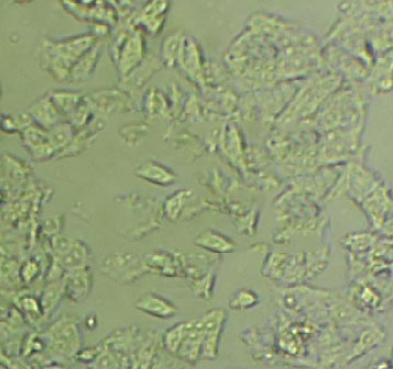 SNU-878 Epithelial Cell|人肝癌传代细胞(有STR鉴定),SNU-878 Epithelial Cell