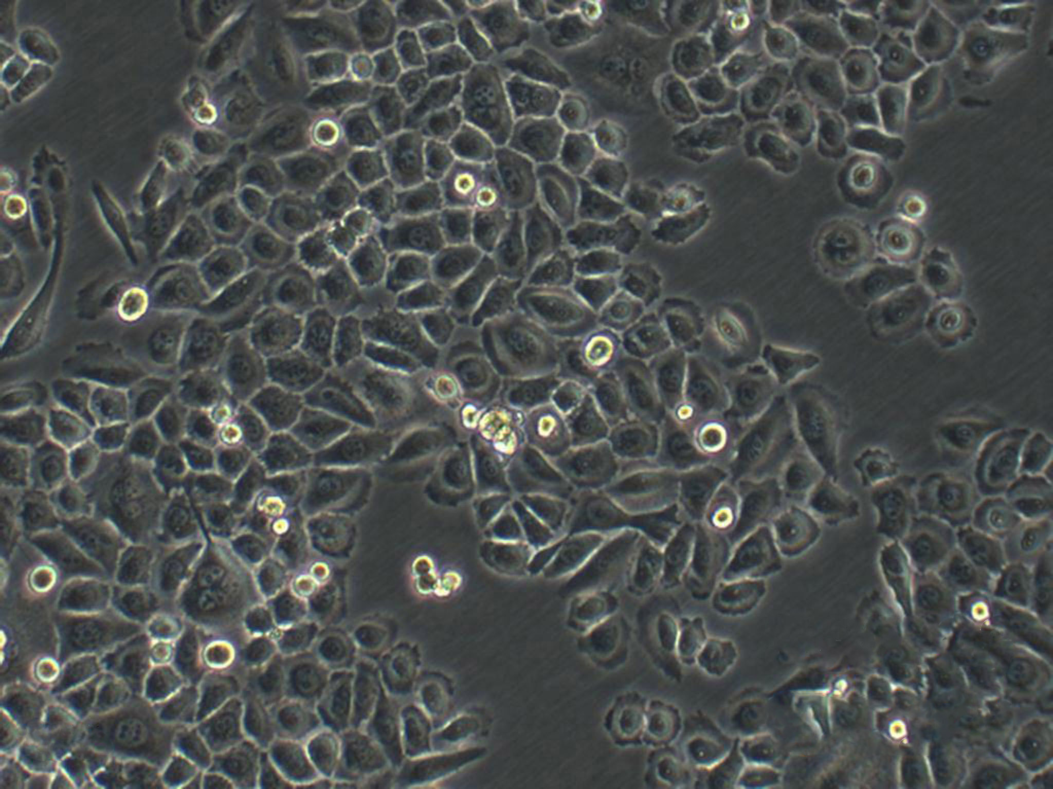 TE-4 Epithelial Cell|人食管癌传代细胞(有STR鉴定),TE-4 Epithelial Cell