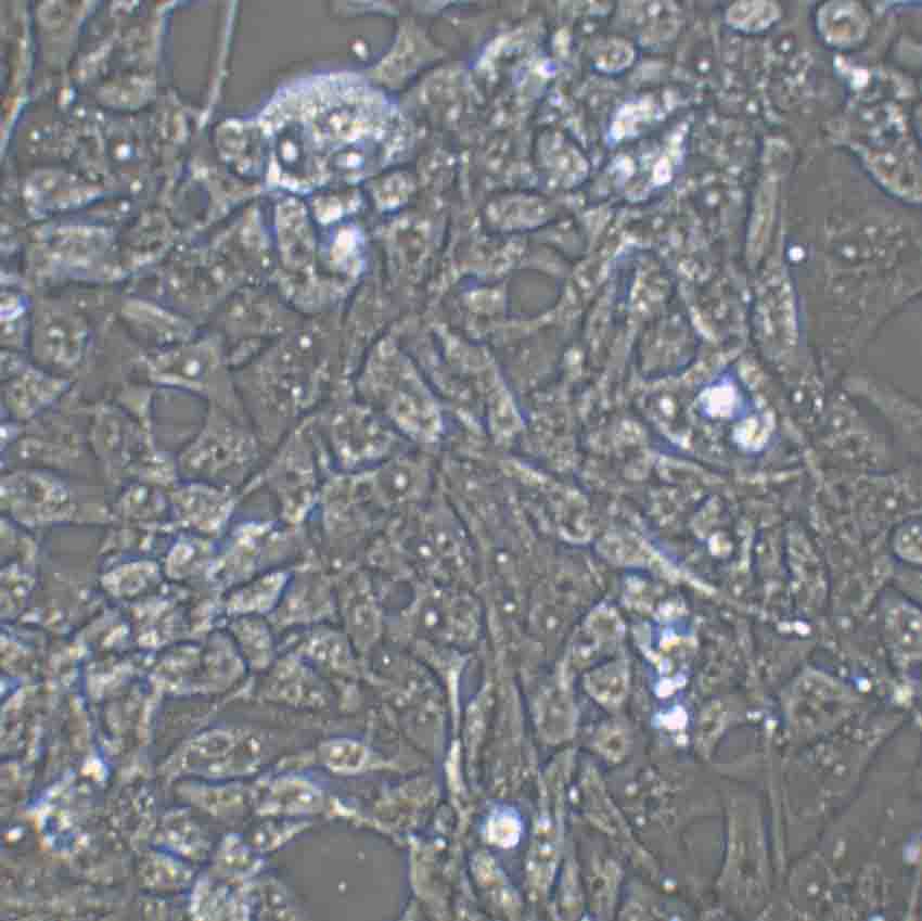 DMS 53 Epithelial Cell|人小细胞肺癌传代细胞(有STR鉴定),DMS 53 Epithelial Cell