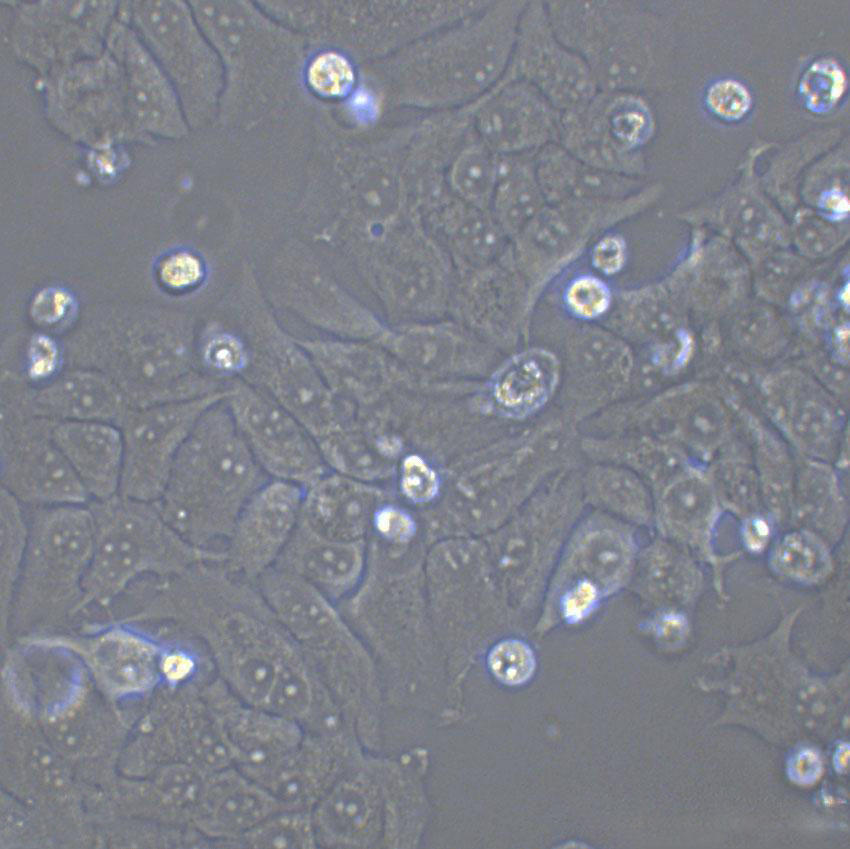 COLO 684 Epithelial Cell|人子宮腺癌傳代細胞(有STR鑒定),COLO 684 Epithelial Cell