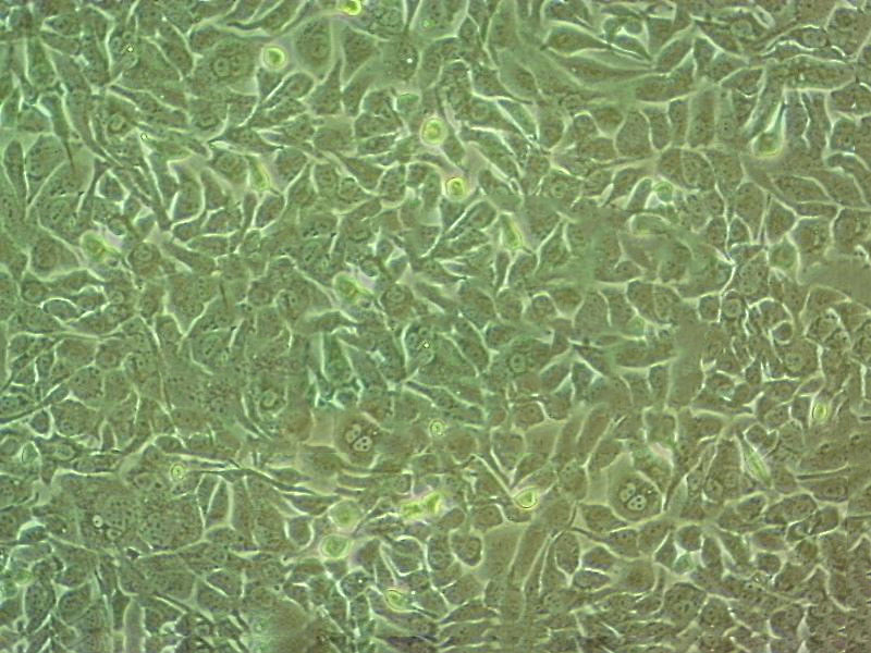 B-CPAP Epithelial Cell|人甲狀腺癌乳頭狀傳代細胞(有STR鑒定),B-CPAP Epithelial Cell