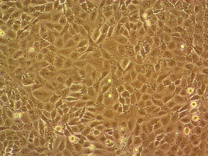 K1 Epithelial Cell|人甲狀腺癌傳代細(xì)胞(有STR鑒定),K1 Epithelial Cell