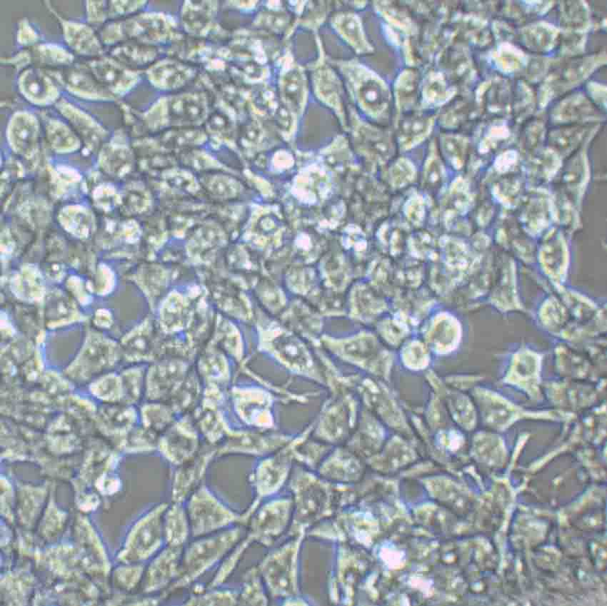 Eca-109 Epithelial Cell|人食管癌傳代細(xì)胞(有STR鑒定),Eca-109 Epithelial Cell