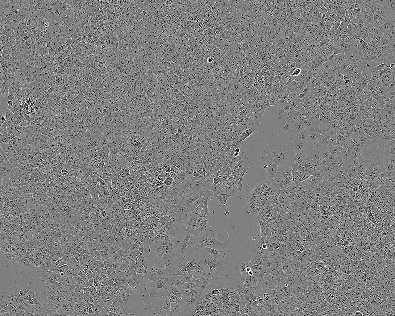 SK-OV-3 Epithelial Cell|人卵巢癌传代细胞(有STR鉴定),SK-OV-3 Epithelial Cell