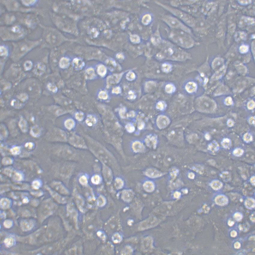 T-47D Epithelial Cell|人乳腺管癌传代细胞(有STR鉴定),T-47D Epithelial Cell