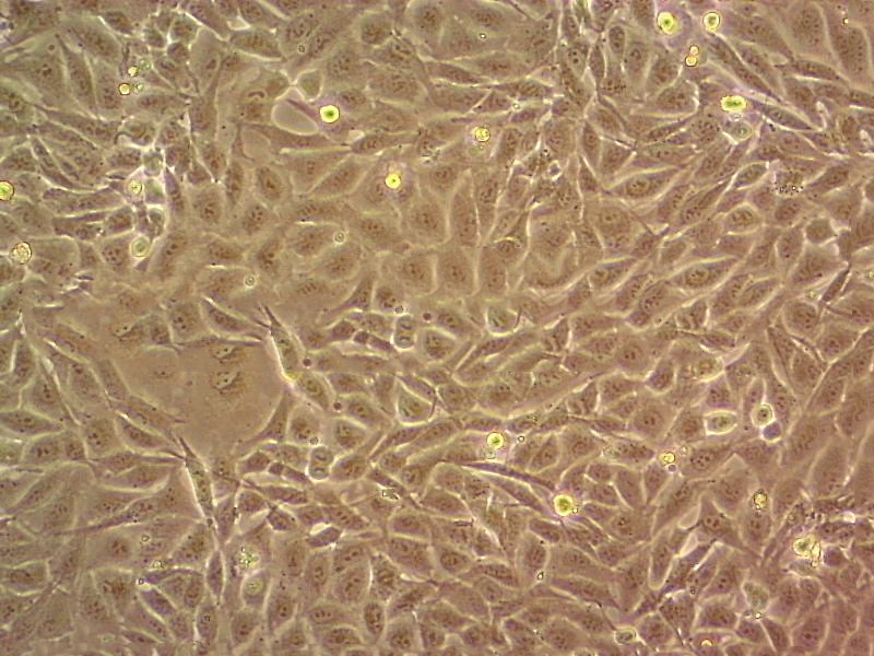 CCD-1095Sk Epithelial Cell|人乳腺浸润性导管癌旁皮肤传代细胞(有STR鉴定),CCD-1095Sk Epithelial Cell