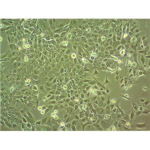 LP-1 Epithelial Cell|人多发性骨髓瘤白传代细胞(有STR鉴定)