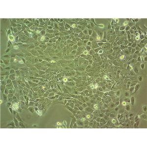 B16-F0 Epithelial Cell|小鼠黑色素瘤传代细胞(有STR鉴定),B16-F0 Epithelial Cell